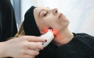 Treating stubborn Acne with Technology