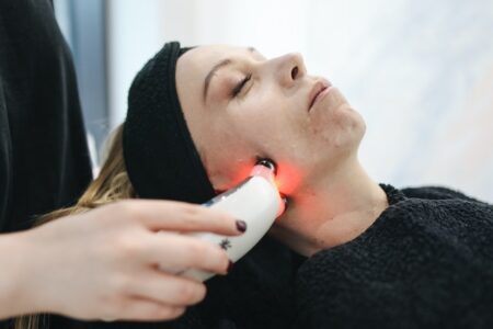 Treating stubborn Acne with Technology
