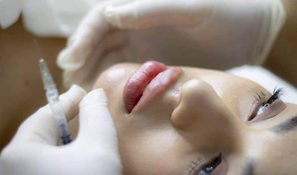 All about lip lift surgery