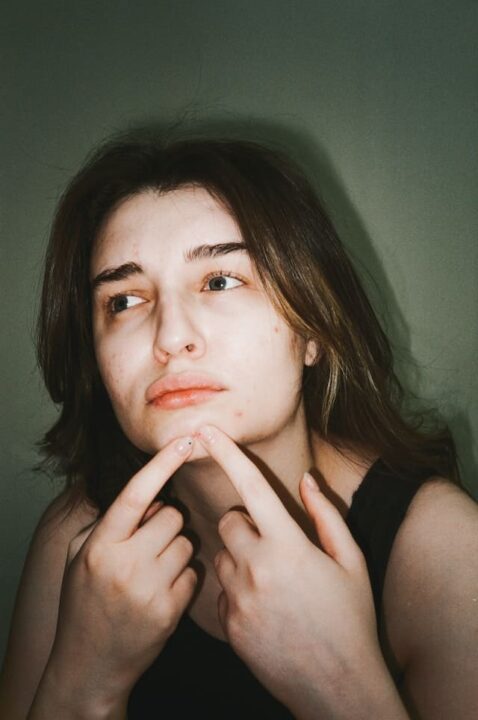 what is period acne and how to treat them